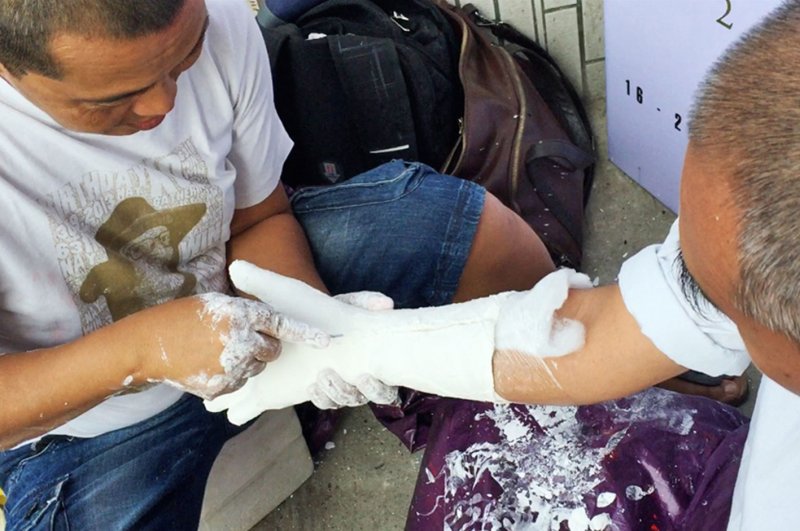 A still image from a video showing a bird's eye view of a man putting white plaster on another man's hand to make a cast